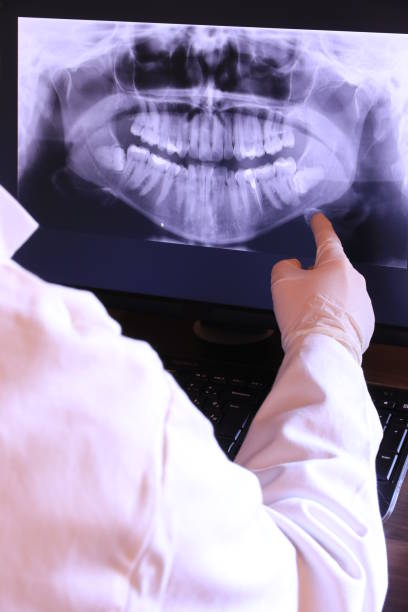 Best Dentist for Tooth Abscess  in Brewster, NY